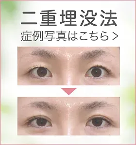 二重埋没法 症例写真はこちら