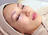 麻酔写真1