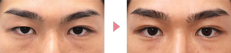 二重写真