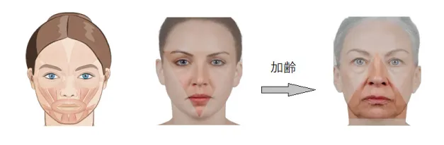 説明図
