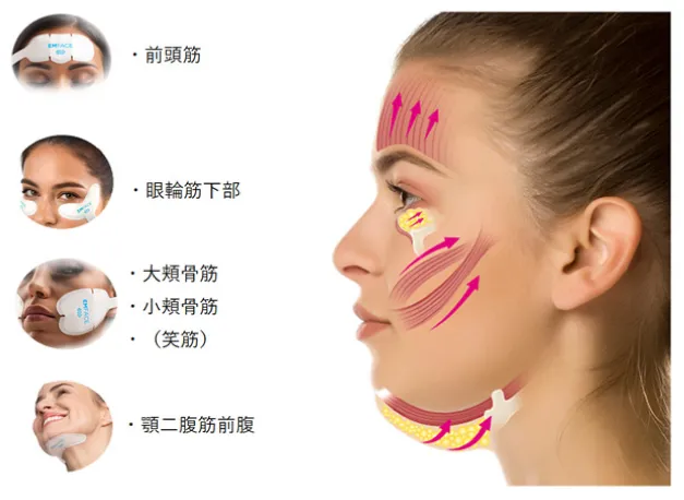 説明図