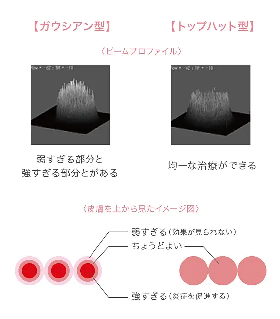 イメージ写真