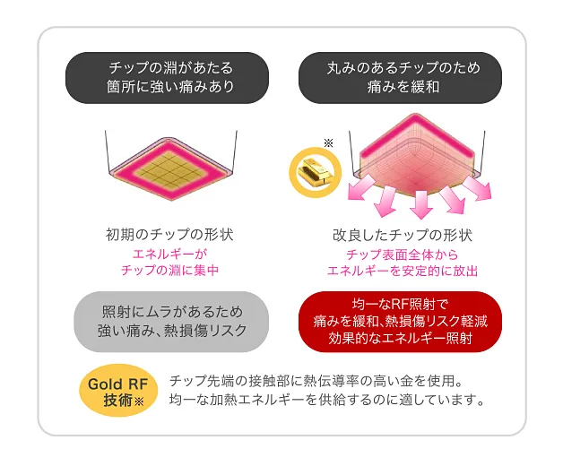 説明図